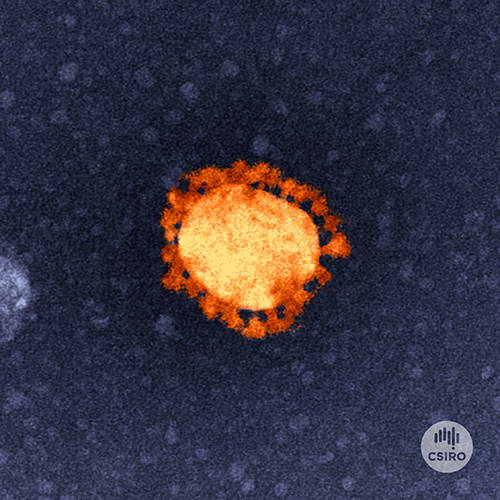 A single SARS-CoV-2 coronavirus particle - round and orange with small red circular components around the edges