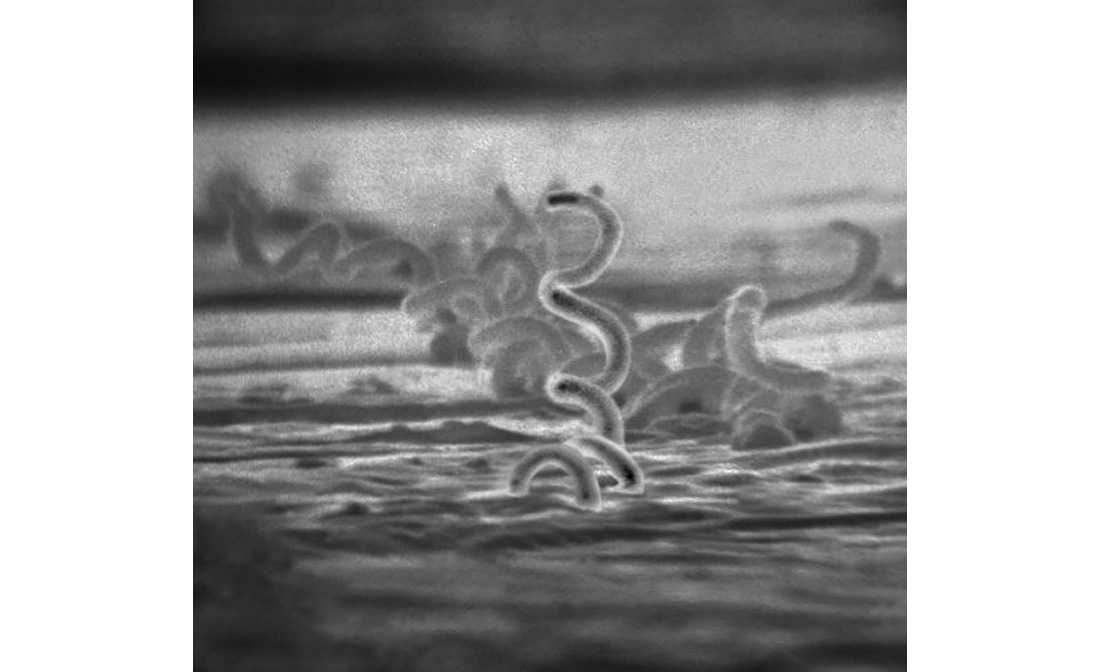 Microscopic black-and-white image showing Electron micrograph of Treponema pallidum, the causative agent of syphilis