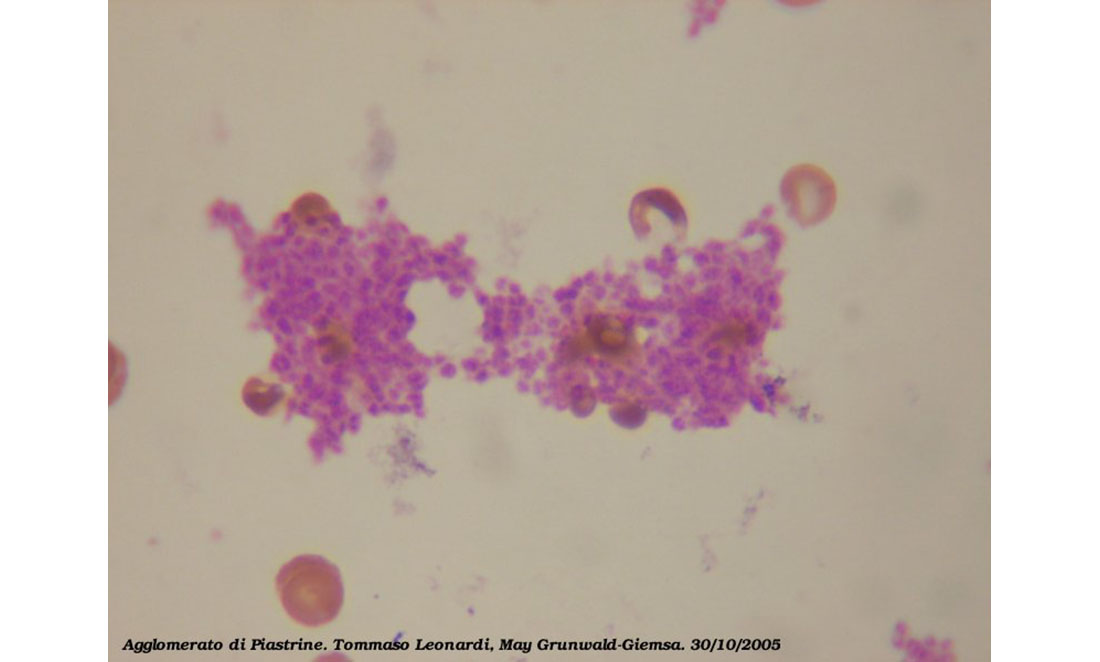 Platelets (small purple dots) dyed and viewed under light microscopy
