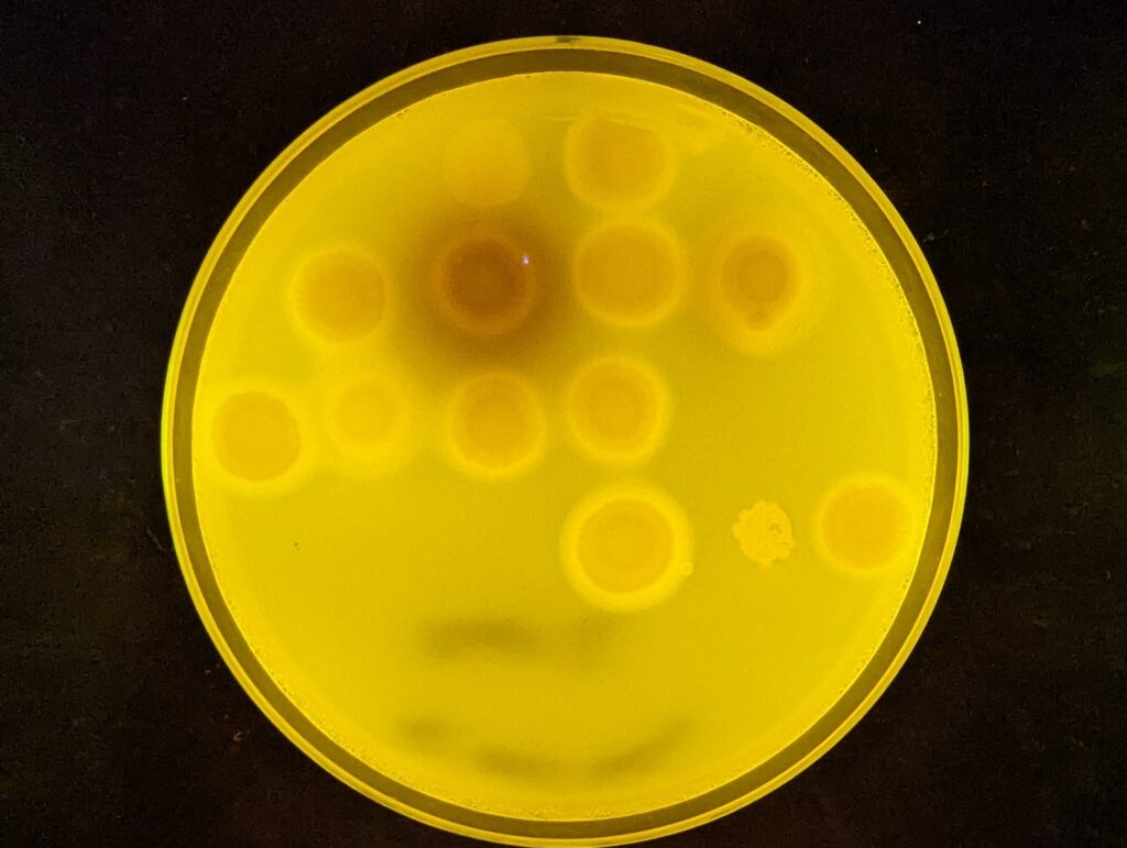 Creating new bacteria to fight plastic