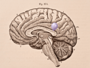 PARTICLE 101: Brain Aneurysms