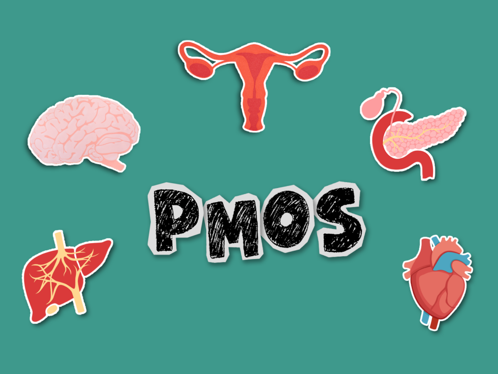 Particle 101: PCOS becomes PMOS