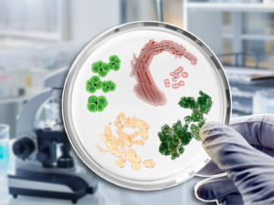 In defence of bacteria
