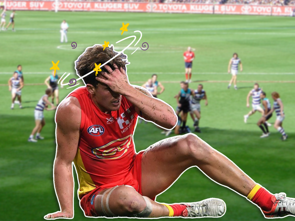 Particle 101: Concussions